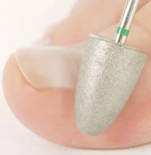 Instrumente*promed Schleifkegel, Saphir grob, nicht autoklavierbar