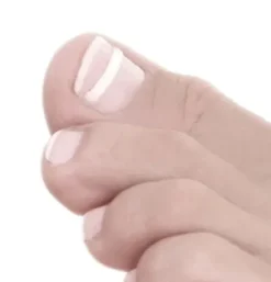 Praxismaterial*3TO Podostripe Spangen inkl. Tupfer